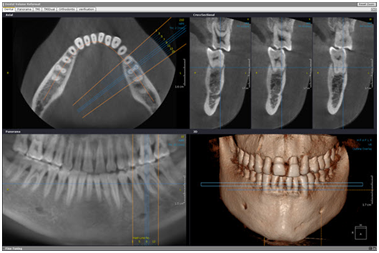 ct pécs, cbct pécs, fogct, fogászati ct, fogorvosi ct, fogröntgen pécs, panoráma fogröntgen, digitális röntgen pécs, cbct ár pécs