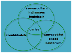 fogfájás okai pécs, demalgon fogfájás, cataflam fogfájás, fájó fog kezelése, foglyuk pécs, lyukas fog, terhesség fogfájás pécs, fájdalomcsillapító