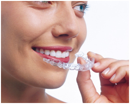 Terapija prozirnim folijama, invisalign, clearsmile, ortodoncija, ortodont mohac, Invisalign tehnika, Samoligirajući estetski fiksni aparat 